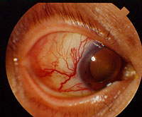 redeye1.jpg (18907 �ֽ�)