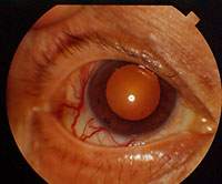 redeye2.jpg (17599 �ֽ�)