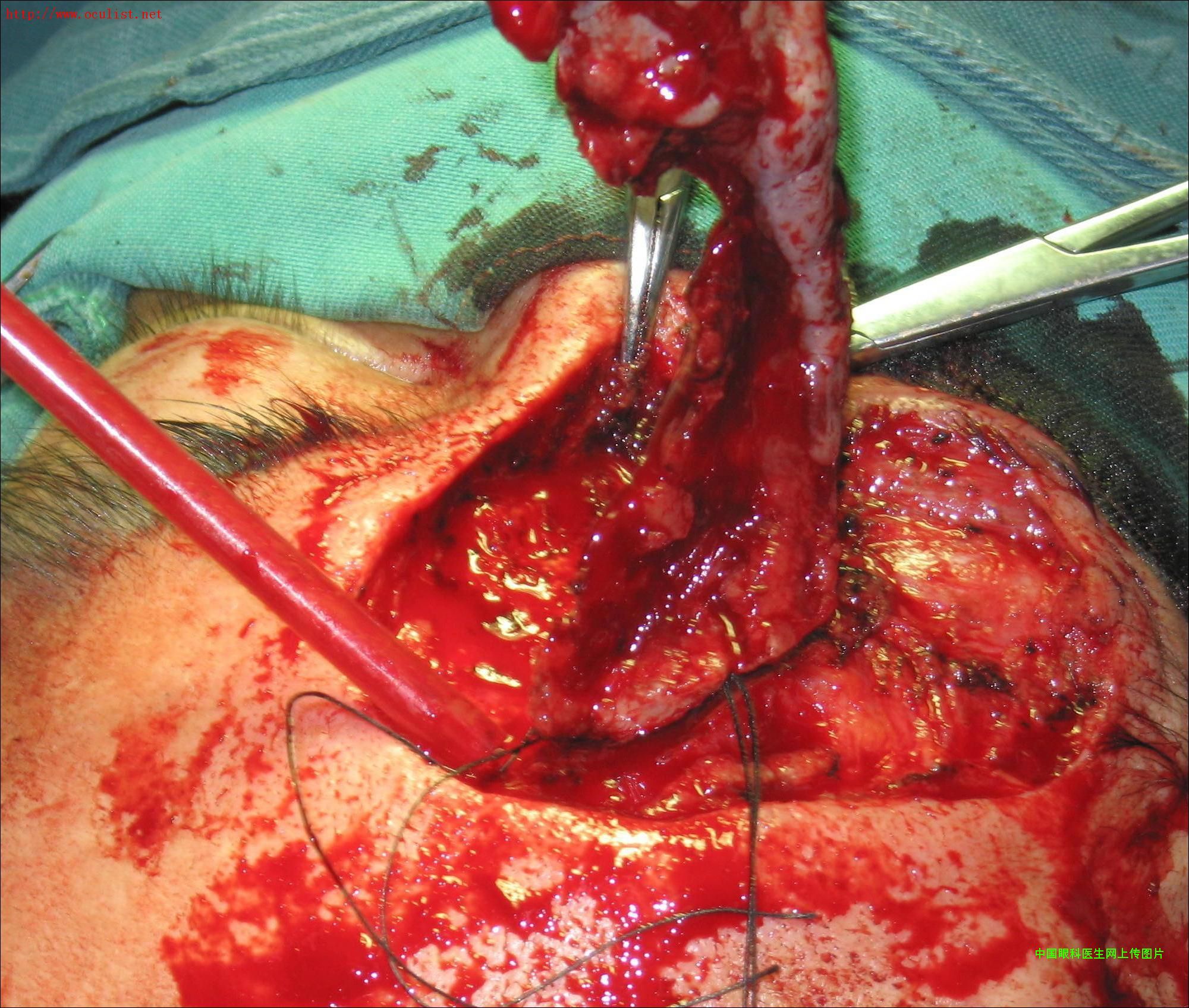 图片点击可在新窗口打开查看