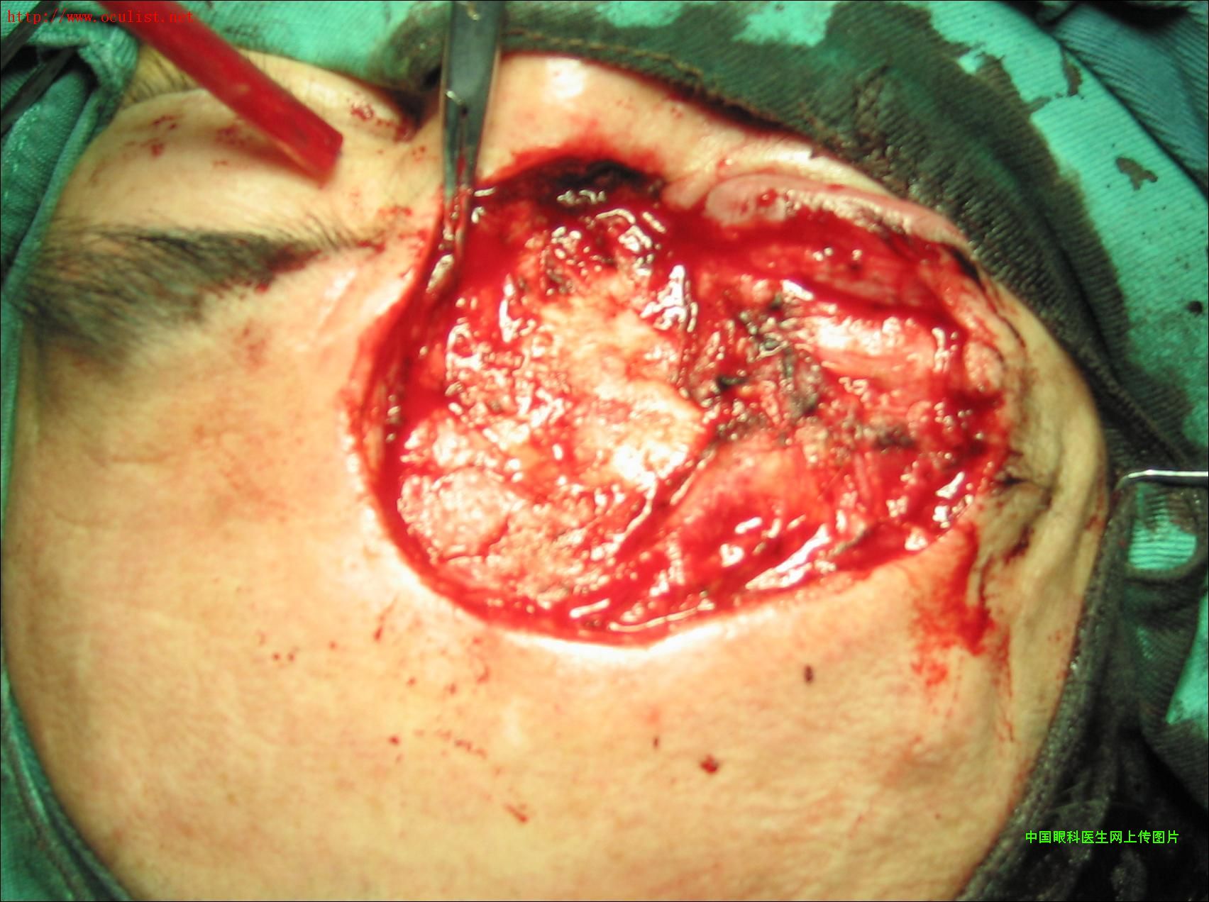 图片点击可在新窗口打开查看