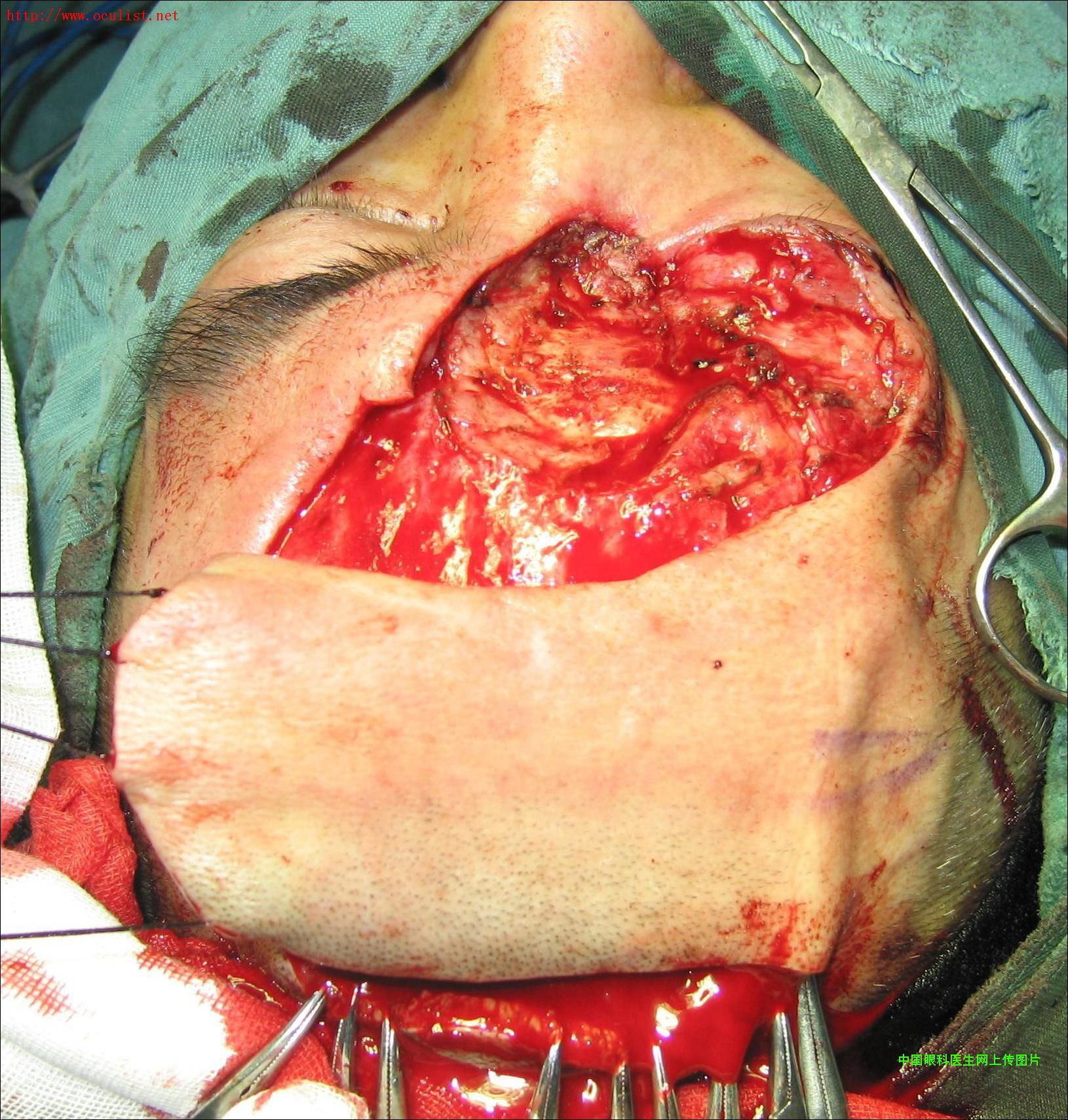 ͼƬ��������´��ڴ򿪲鿴