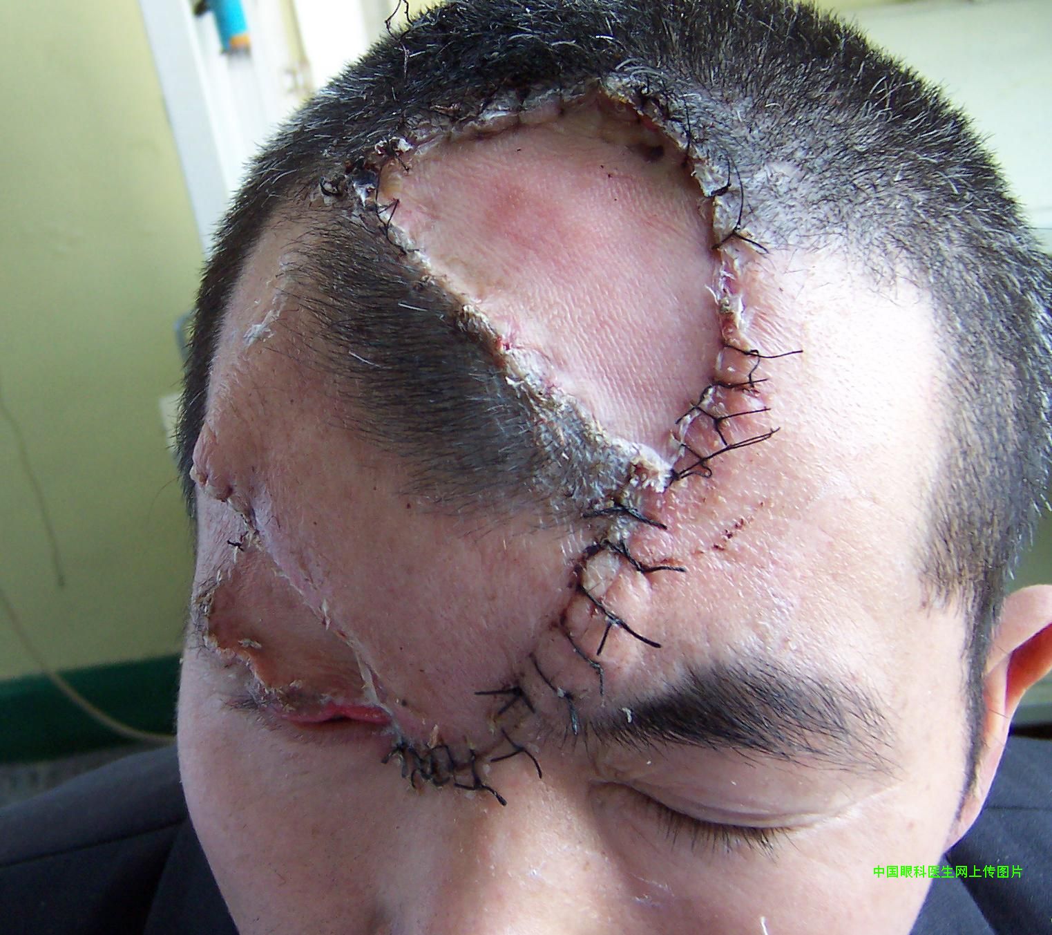 ͼƬ��������´��ڴ򿪲鿴