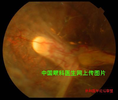 图片点击可在新窗口打开查看