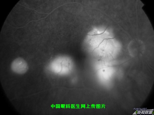 ͼƬ��������´��ڴ򿪲鿴