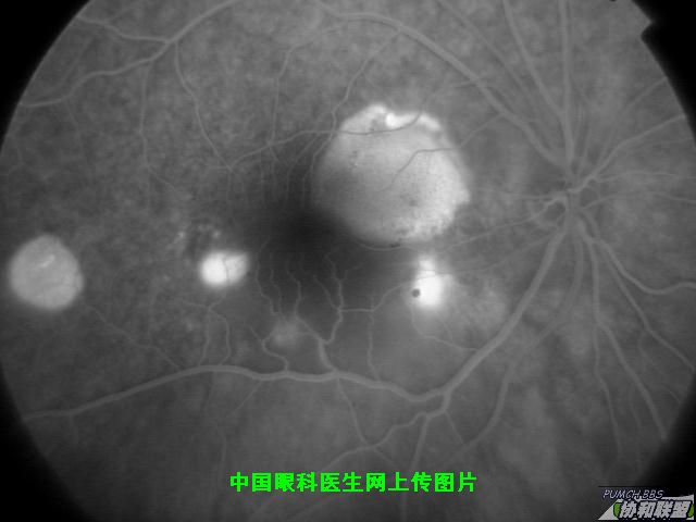 ͼƬ��������´��ڴ򿪲鿴